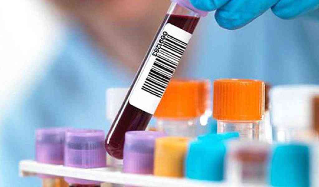 Наркотики в крови: лабораторный метод определения
