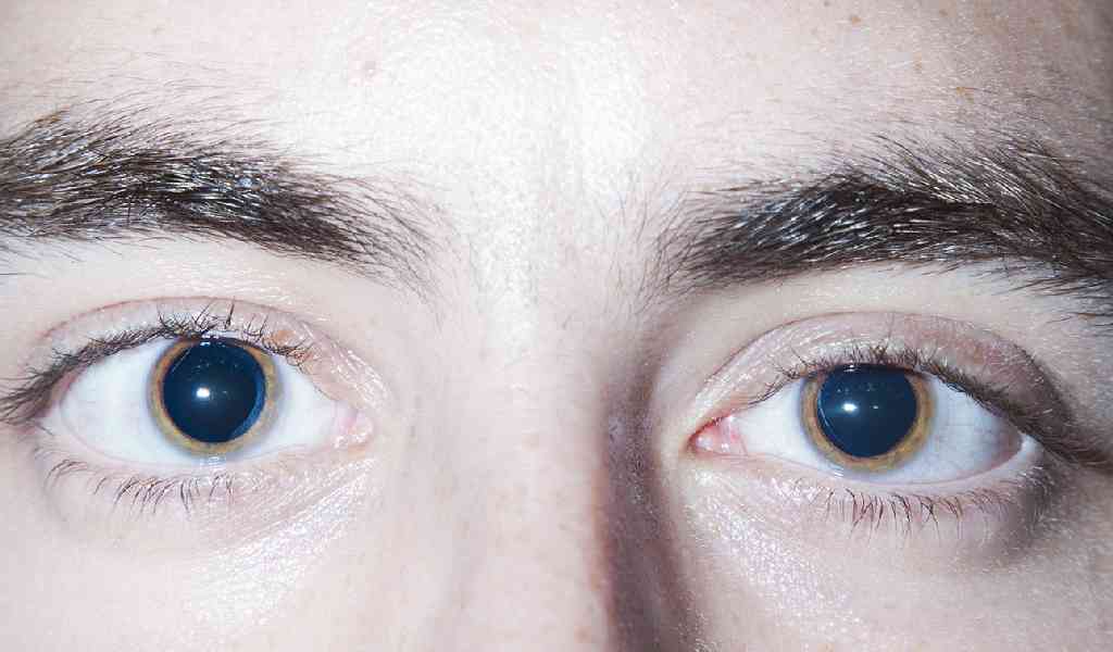 Внешность наркомана - глаза